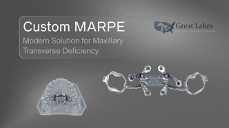 Great-Lakes-Introduces-Unique-Custom-MARPE-Appliance